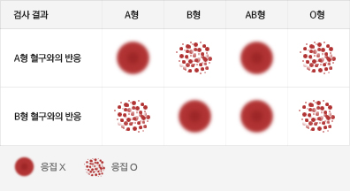 ABO 혈액형 검사(혈청형)