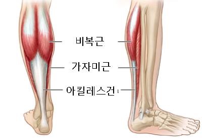 그림 1. 아킬레스건의 구조