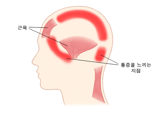 통증을 느끼는 지점