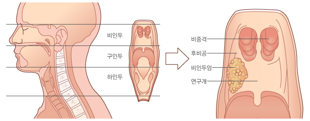 비인두의 구조