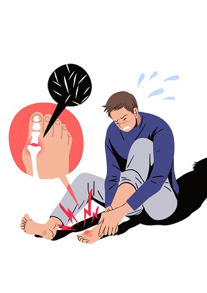 통풍